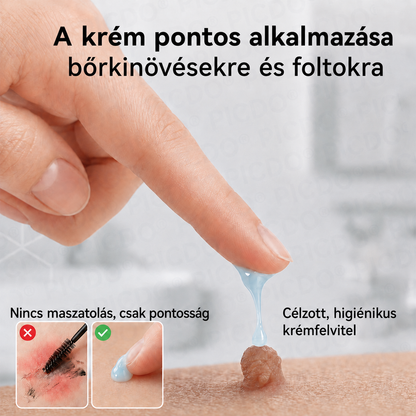 🔥 Picdo® 7 napos Bőrnövedék- és Foltápoló Krém | 🌿 Célzott Növényi Formula | ✨ Simább Bőr | 🇭🇺 Magyarországon gyártva