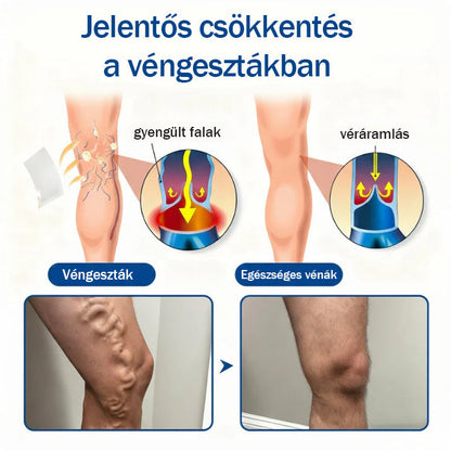 🧑‍⚕️ Medistart® Visszérápoló Mikrotűs Gondozó Tapasz ⚡ Azonnali Megkönnyebbülés, Hosszú Távú Eredmények