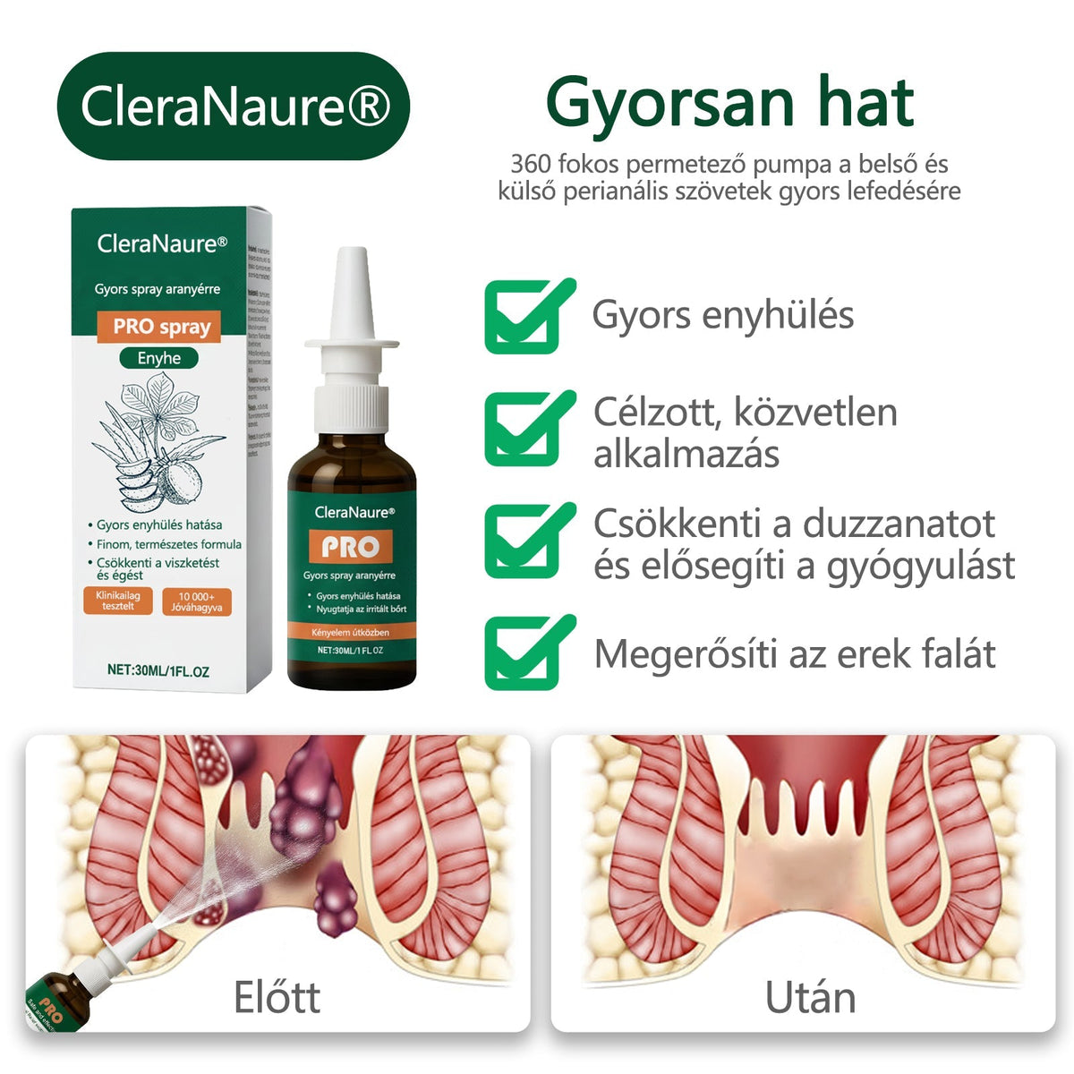 CleraNaure® Gyors Hatású Aranyér PRO Spray 🌿 – Természetes Növényi Formula a Kényelmesebb Ülésért és Mozgásért 🎁
