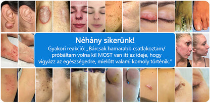 CleraNature® Magnéziumos Gyógyfüves Bőrnyugtató Spray ✨ – Természetes Növényi Formula Száraz, Érzékeny és Problémás Bőr Mindennapi Ápolására 🌿
