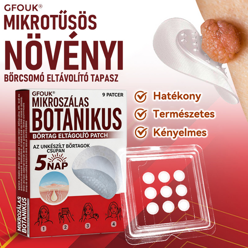 🍀 GFOUK® Mikrotűs Bőrkinövés & Foltápoló Tapasz ✨ | 9 db Természetes Növényi Hatóanyagú Bőrmegújító Patch 🌿 Bőrkinövések, Szemölcsök, Anyajegyek és Pigmentfoltok Célzott Ápolására