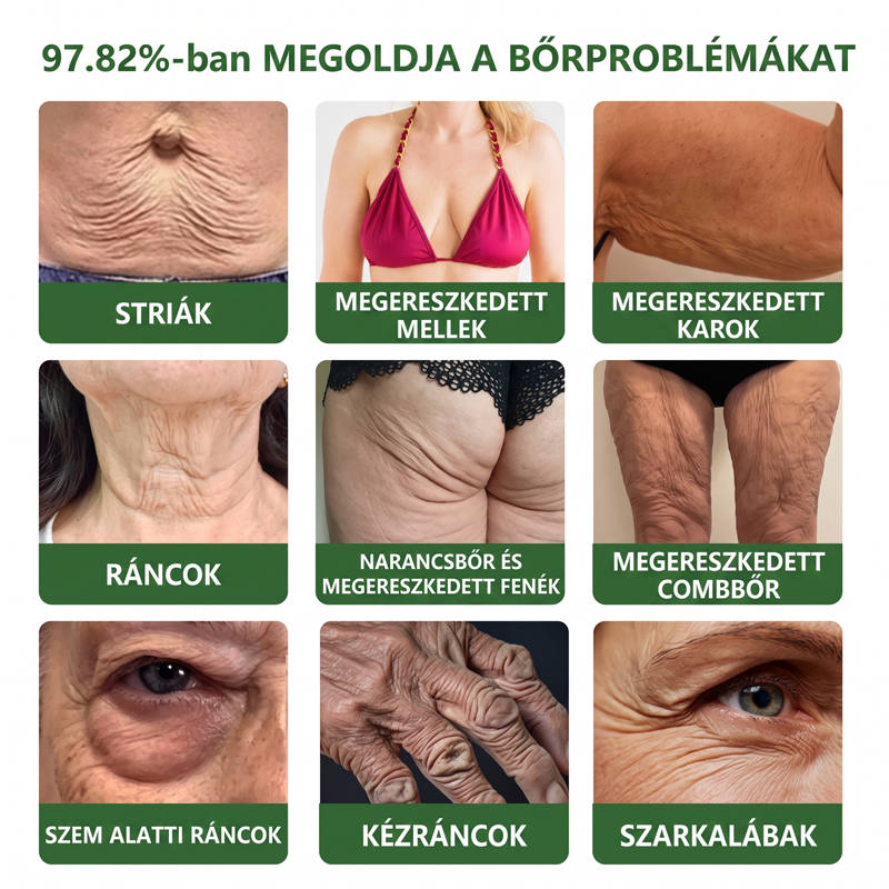 𝐇𝐢𝐬𝐤𝐢𝐧® PDRN Peptide Renewal Stick – Fejlett PDRN Peptid Bőrmegújító Stift | ✨ Ráncok, Sötét Foltok & Laza Bőr Célzott Ápolása | 💎 Feszesebb, Simább & Egyenletesebb Megjelenés | 🎯 Arcra & Testre |