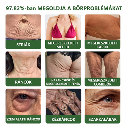 𝐇𝐢𝐬𝐤𝐢𝐧® PDRN Peptide Renewal Stick – Fejlett PDRN Peptid Bőrmegújító Stift | ✨ Ráncok, Sötét Foltok & Laza Bőr Célzott Ápolása | 💎 Feszesebb, Simább & Egyenletesebb Megjelenés | 🎯 Arcra & Testre |