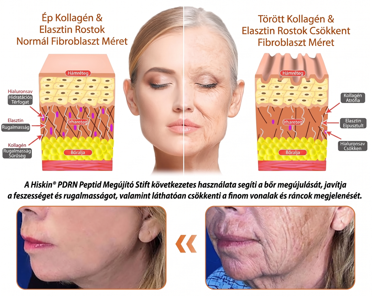 𝐇𝐢𝐬𝐤𝐢𝐧® PDRN Peptide Renewal Stick – Fejlett PDRN Peptid Bőrmegújító Stift | ✨ Ráncok, Sötét Foltok & Laza Bőr Célzott Ápolása | 💎 Feszesebb, Simább & Egyenletesebb Megjelenés | 🎯 Arcra & Testre |
