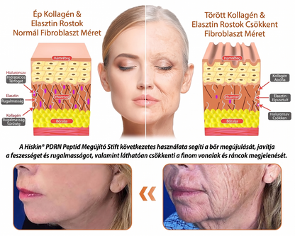 𝐇𝐢𝐬𝐤𝐢𝐧® PDRN Peptide Renewal Stick – Fejlett PDRN Peptid Bőrmegújító Stift | ✨ Ráncok, Sötét Foltok & Laza Bőr Célzott Ápolása | 💎 Feszesebb, Simább & Egyenletesebb Megjelenés | 🎯 Arcra & Testre |