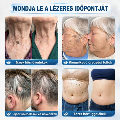 👩‍⚕️🍋‍🟩𝐏𝒊𝐜𝐝𝒐® 7 𝑵𝒂𝒑𝒐𝒔 𝑩ö𝒓𝒌𝒊𝒏ö𝒗é𝒔- É𝒔 𝑭𝒐𝒍𝒕𝒆𝒍𝒕á𝒗𝒐𝒍í𝒕ó(𝐹á𝑗𝑑𝑎𝑙𝑜𝑚 𝑛é𝑙𝑘ü𝑙, ℎ𝑒𝑔𝑒𝑘 𝑛é𝑙𝑘ü𝑙 – 𝑟𝑜𝑙𝑙𝑒𝑟𝑏𝑎𝑙𝑙) 💪