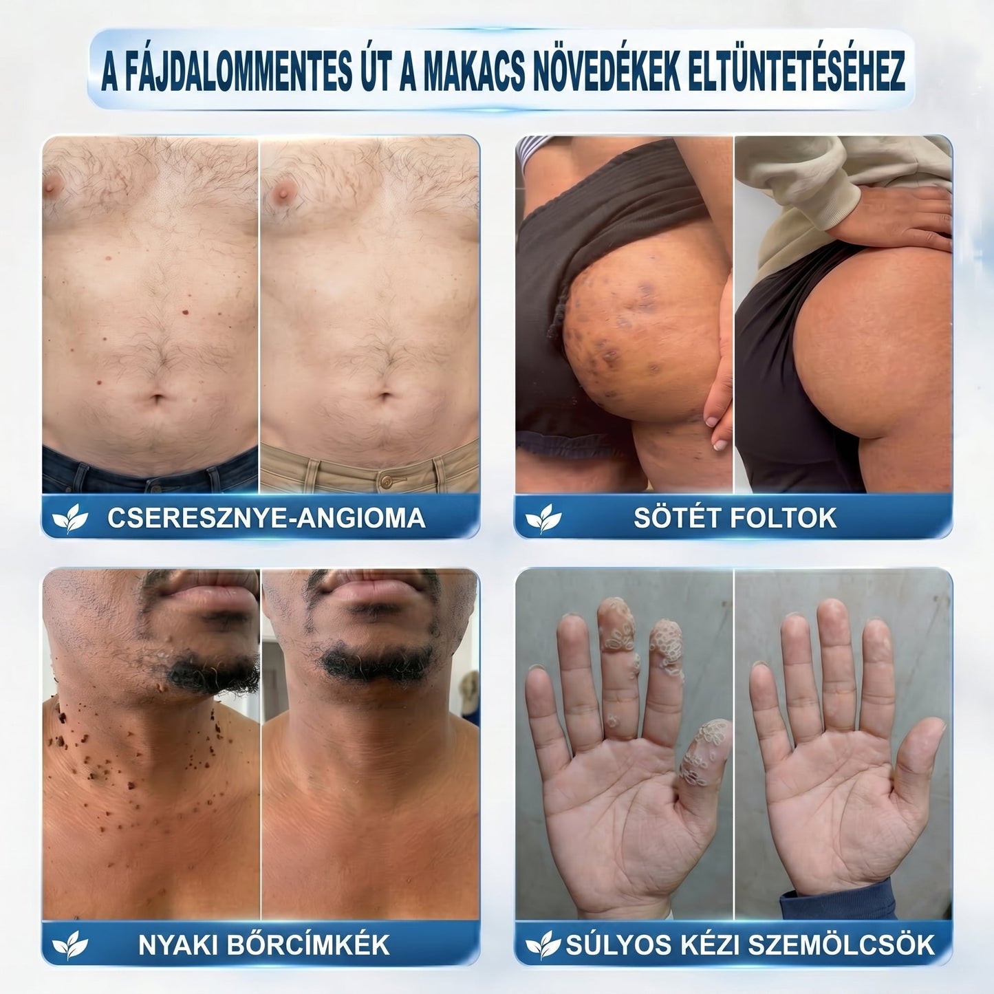 👩‍⚕️🍋‍🟩𝐏𝒊𝐜𝐝𝒐® 7 𝑵𝒂𝒑𝒐𝒔 𝑩ö𝒓𝒌𝒊𝒏ö𝒗é𝒔- É𝒔 𝑭𝒐𝒍𝒕𝒆𝒍𝒕á𝒗𝒐𝒍í𝒕ó(𝐹á𝑗𝑑𝑎𝑙𝑜𝑚 𝑛é𝑙𝑘ü𝑙, ℎ𝑒𝑔𝑒𝑘 𝑛é𝑙𝑘ü𝑙 – 𝑟𝑜𝑙𝑙𝑒𝑟𝑏𝑎𝑙𝑙) 💪