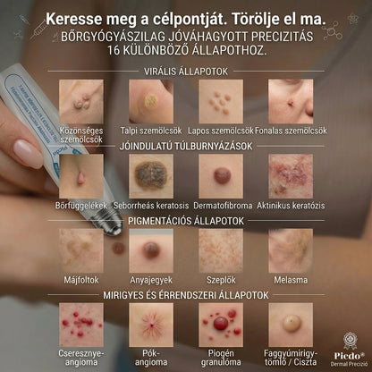 👩‍⚕️🍋‍🟩𝐏𝒊𝐜𝐝𝒐® 7 𝑵𝒂𝒑𝒐𝒔 𝑩ö𝒓𝒌𝒊𝒏ö𝒗é𝒔- É𝒔 𝑭𝒐𝒍𝒕𝒆𝒍𝒕á𝒗𝒐𝒍í𝒕ó(𝐹á𝑗𝑑𝑎𝑙𝑜𝑚 𝑛é𝑙𝑘ü𝑙, ℎ𝑒𝑔𝑒𝑘 𝑛é𝑙𝑘ü𝑙 – 𝑟𝑜𝑙𝑙𝑒𝑟𝑏𝑎𝑙𝑙) 💪
