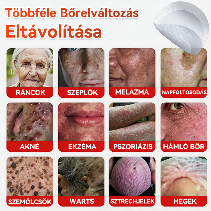 🍀 GFOUK® Mikrotűs Bőrkinövés & Foltápoló Tapasz ✨ | 9 db Természetes Növényi Hatóanyagú Bőrmegújító Patch 🌿 Bőrkinövések, Szemölcsök, Anyajegyek és Pigmentfoltok Célzott Ápolására
