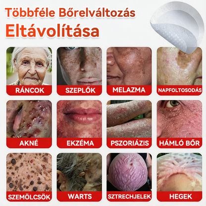 🍀 GFOUK® Mikrotűs Bőrkinövés & Foltápoló Tapasz ✨ | 9 db Természetes Növényi Hatóanyagú Bőrmegújító Patch 🌿 Bőrkinövések, Szemölcsök, Anyajegyek és Pigmentfoltok Célzott Ápolására