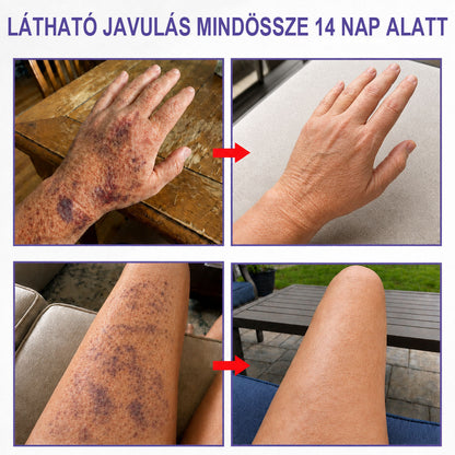 ✨ CleraNaure® Arni-K Recovery Complex | 🌿 Arnica + K-vitaminos Testápoló | 🟣 Zúzódásnyomok & Elszíneződések | 🌑 Sötét & Pigmentfoltok | 💧 Egyenetlen Bőrtónus | 🌸 Mindennapi Ápolás 🔥