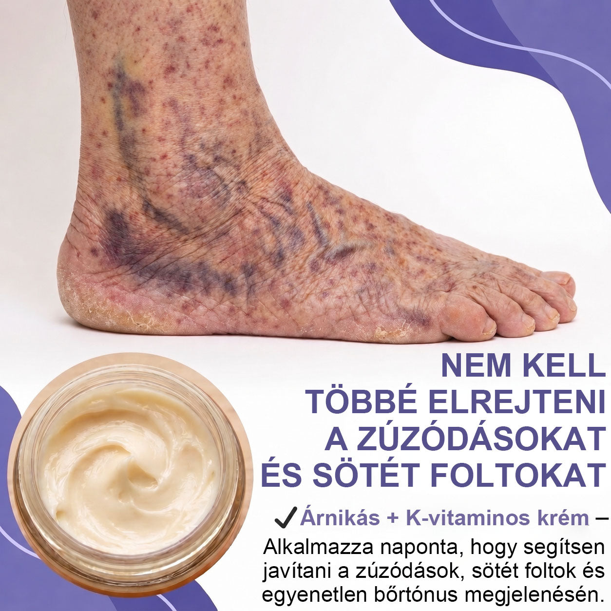 ✨ CleraNaure® Arni-K Recovery Complex | 🌿 Arnica + K-vitaminos Testápoló | 🟣 Zúzódásnyomok & Elszíneződések | 🌑 Sötét & Pigmentfoltok | 💧 Egyenetlen Bőrtónus | 🌸 Mindennapi Ápolás 🔥
