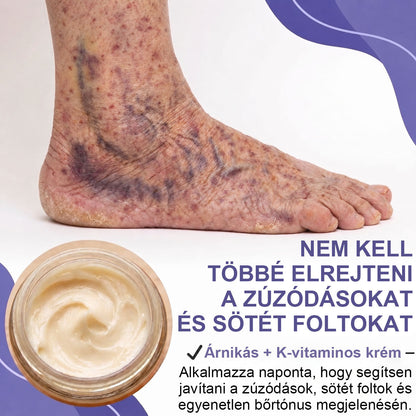 ✨ CleraNaure® Arni-K Recovery Complex | 🌿 Arnica + K-vitaminos Testápoló | 🟣 Zúzódásnyomok & Elszíneződések | 🌑 Sötét & Pigmentfoltok | 💧 Egyenetlen Bőrtónus | 🌸 Mindennapi Ápolás 🔥