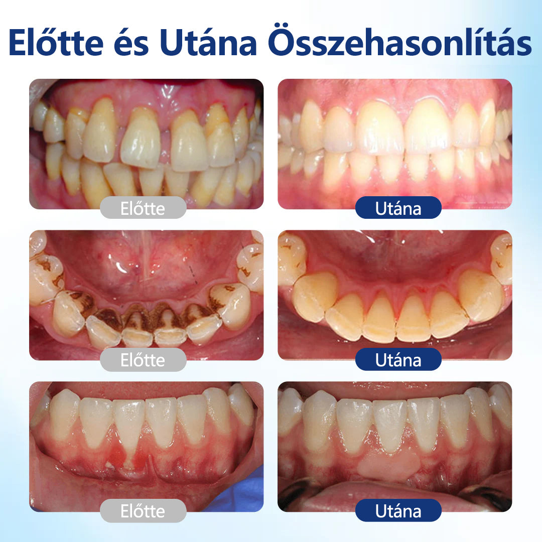 🐝 CleraNaure® BeeTakt Prémium Méhméreg Szájápoló Javító Oldat 🦷 – Q10, Hialuronsav és Természetes Növényi Formula az Egészséges Ínyért és Erősebb Mosolyért