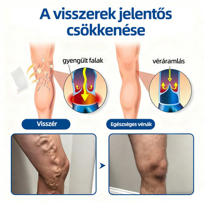 Healrize® VeinTarget™ Mikrotűs Tapasz – Segít Csökkenteni a Lábfáradtságot, Duzzanatot és Támogatja az Egészséges Vénás Keringést 🦵🌿