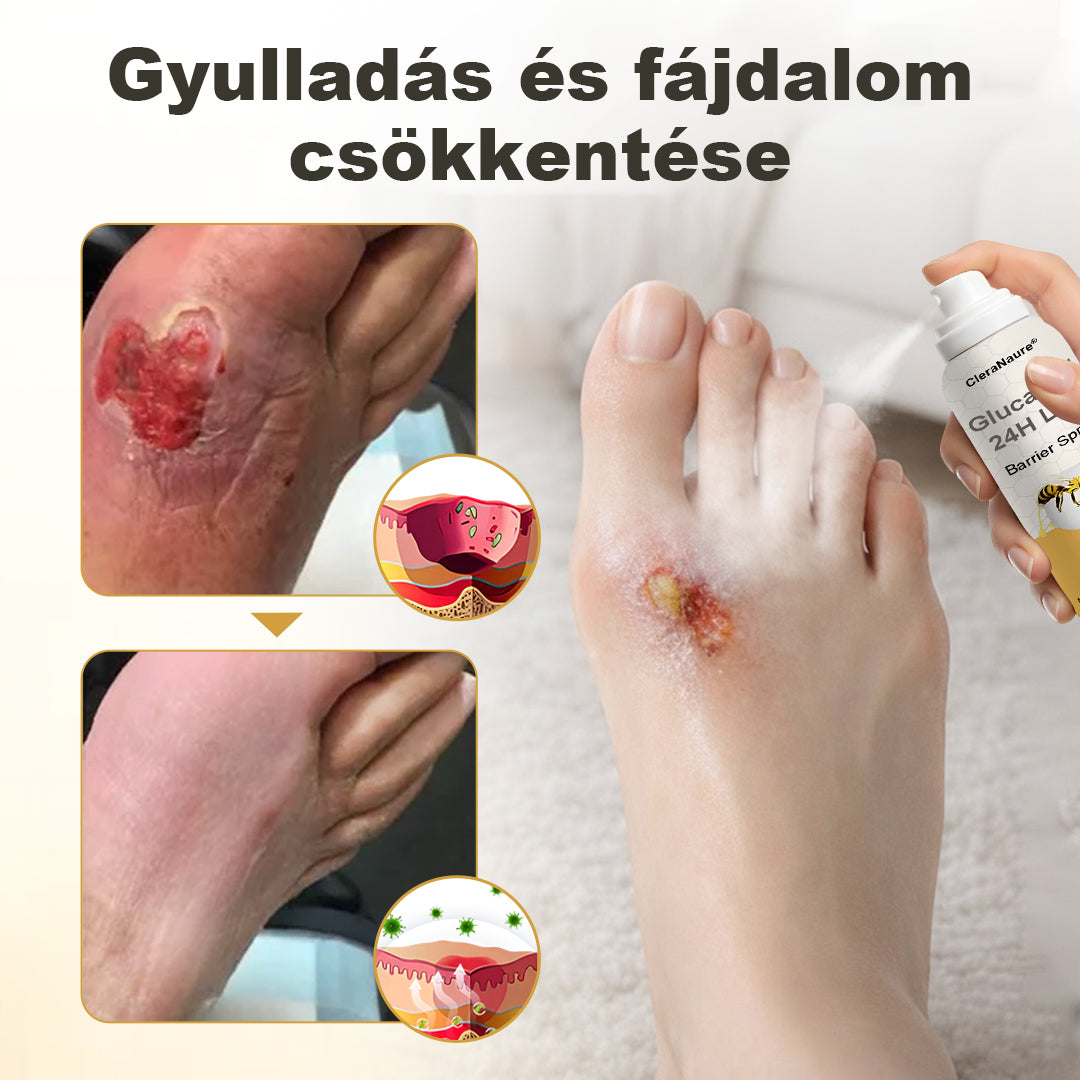 CleraNaure® GlucaVeil 24H Lábvédő Spray 🌿 – Természetes Védőformula Érzékeny és Száraz Láb Bőrének Mindennapi Ápolására 🦶