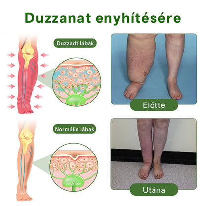 🌿 Buzora® Professional Lábkeringést Támogató Krém | 🦵 Micro-Mist Transzdermális Technológia | 💧 Duzzadt & Nehéz Lábak Ápolására | ✨ Mindennapi Komfortért