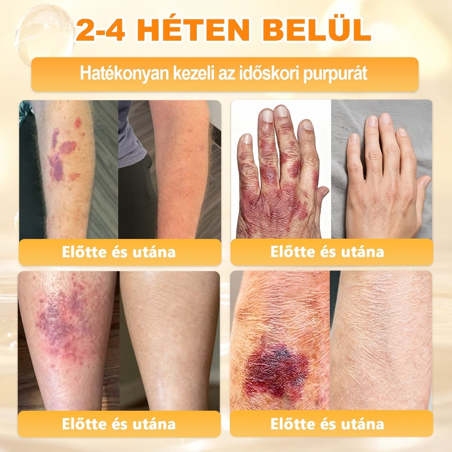 Ajánlott a Semmelweis Kórház által · BENU hivatalos üzlet✨✨ 𝖠𝖯𝖪𝖠𝖯𝖪® méhméreges bőrmegújító krém
