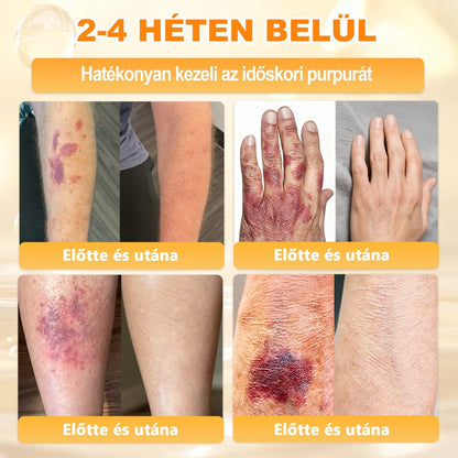 Ajánlott a Semmelweis Kórház által · BENU hivatalos üzlet✨✨ 𝖠𝖯𝖪𝖠𝖯𝖪® méhméreges bőrmegújító krém