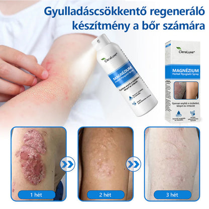 CleraNature® Magnéziumos Gyógyfüves Bőrnyugtató Spray ✨ – Természetes Növényi Formula Száraz, Érzékeny és Problémás Bőr Mindennapi Ápolására 🌿