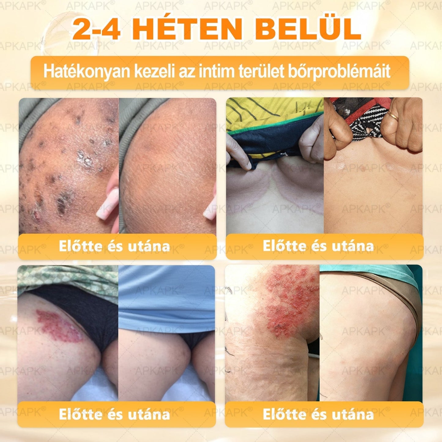 Ajánlott a Semmelweis Kórház által · BENU hivatalos üzlet✨✨ 𝖠𝖯𝖪𝖠𝖯𝖪® méhméreges bőrmegújító krém