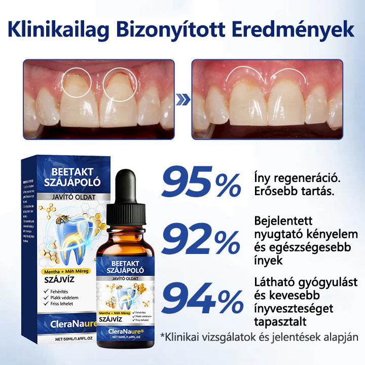 🐝 CleraNaure® BeeTakt Prémium Méhméreg Szájápoló Javító Oldat 🦷 – Q10, Hialuronsav és Természetes Növényi Formula az Egészséges Ínyért és Erősebb Mosolyért