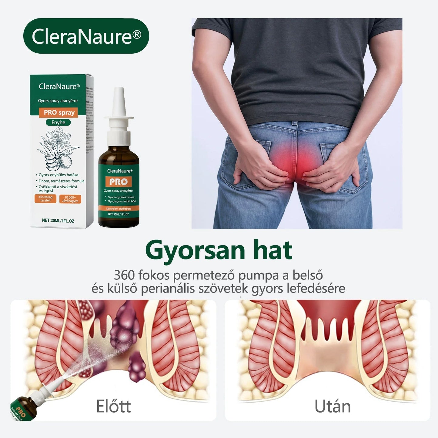 CleraNaure® Gyors Hatású Aranyér PRO Spray 🌿 – Természetes Növényi Formula a Kényelmesebb Ülésért és Mozgásért 🎁
