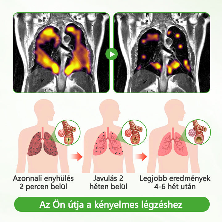 CleraNaure® HerbaAir Mullein Kivonatos Orrinhalátor ⭐ Természetes Gyógynövényes Formula Mindennapi Használatra 🔥