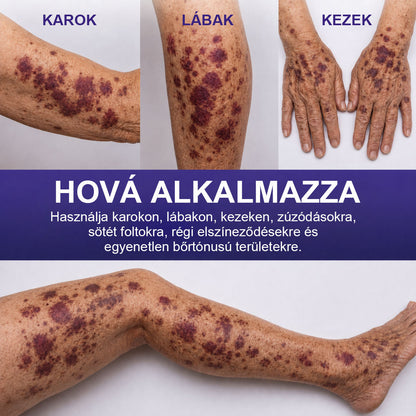 ✨ CleraNaure® Arni-K Recovery Complex | 🌿 Arnica + K-vitaminos Testápoló | 🟣 Zúzódásnyomok & Elszíneződések | 🌑 Sötét & Pigmentfoltok | 💧 Egyenetlen Bőrtónus | 🌸 Mindennapi Ápolás 🔥