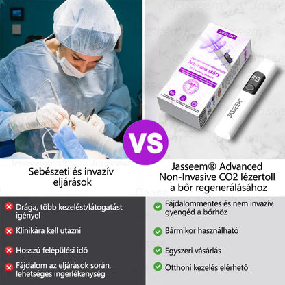 𝐉𝐚𝐬𝐬𝐞𝐞𝐦® Fejlett, nem invazív bőrjavító CO₂ lézeres toll 🎉 (Gyengéden eltávolítja a szemölcsöket, anyajegyeket, öregségi foltokat és bőrkinövéseket – fájdalom és gond nélkül!)