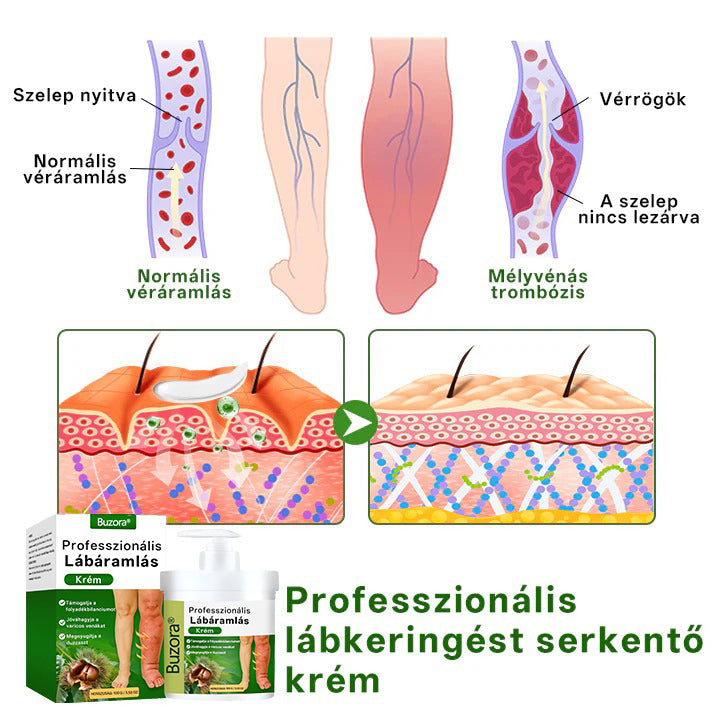 🌿 Buzora® Professional Lábkeringést Támogató Krém | 🦵 Micro-Mist Transzdermális Technológia | 💧 Duzzadt & Nehéz Lábak Ápolására | ✨ Mindennapi Komfortért
