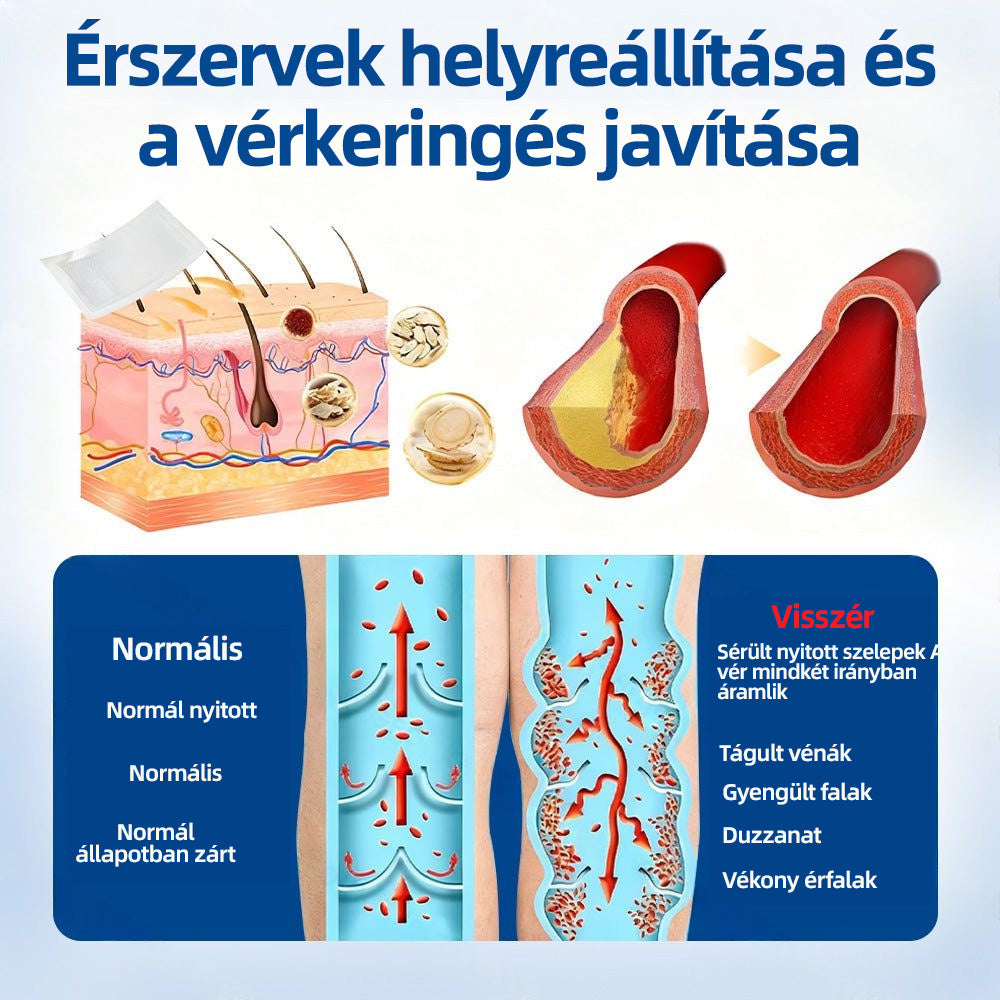 Healrize® VeinTarget™ Mikrotűs Tapasz – Segít Csökkenteni a Lábfáradtságot, Duzzanatot és Támogatja az Egészséges Vénás Keringést 🦵🌿