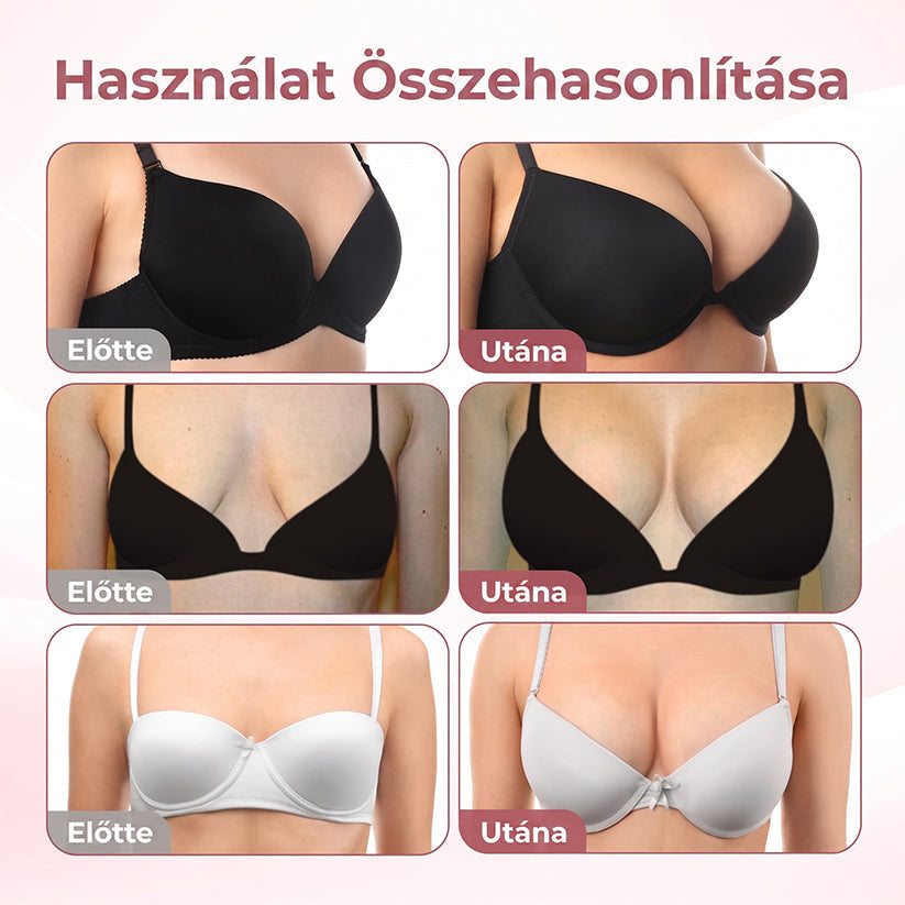 🔥 HISKIN® Nano Mikrotűs Mellvolumen-növelő és Feszesítő Kezelés ✨ Fejlett Nőies Kontúrápoló Rendszer | Kollagénpeptid és Hialuronsav Technológia 🌸