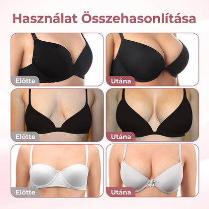 🔥 HISKIN® Nano Mikrotűs Mellvolumen-növelő és Feszesítő Kezelés ✨ Fejlett Nőies Kontúrápoló Rendszer | Kollagénpeptid és Hialuronsav Technológia 🌸