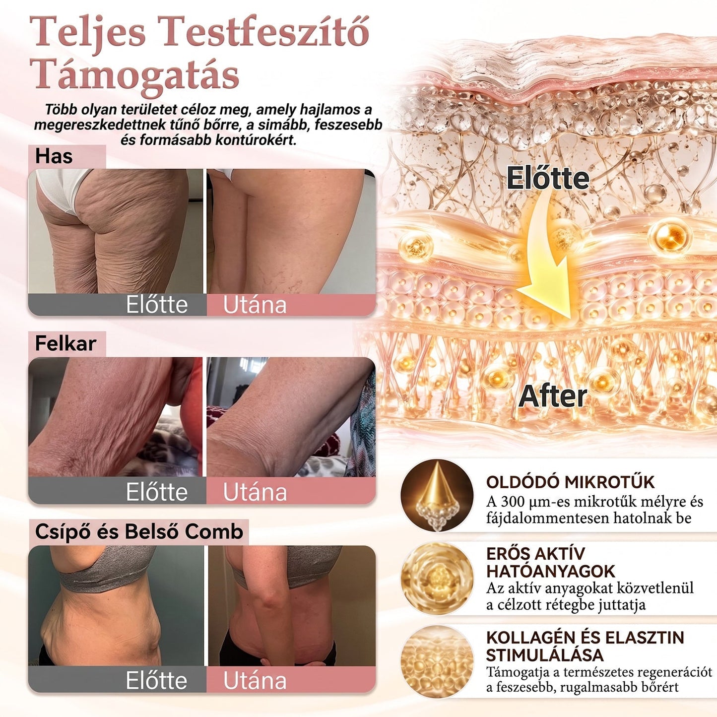 🔥 HISKIN® Nano Mikrotűs Mellvolumen-növelő és Feszesítő Kezelés ✨ Fejlett Nőies Kontúrápoló Rendszer | Kollagénpeptid és Hialuronsav Technológia 🌸