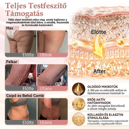 🔥 HISKIN® Nano Mikrotűs Mellvolumen-növelő és Feszesítő Kezelés ✨ Fejlett Nőies Kontúrápoló Rendszer | Kollagénpeptid és Hialuronsav Technológia 🌸