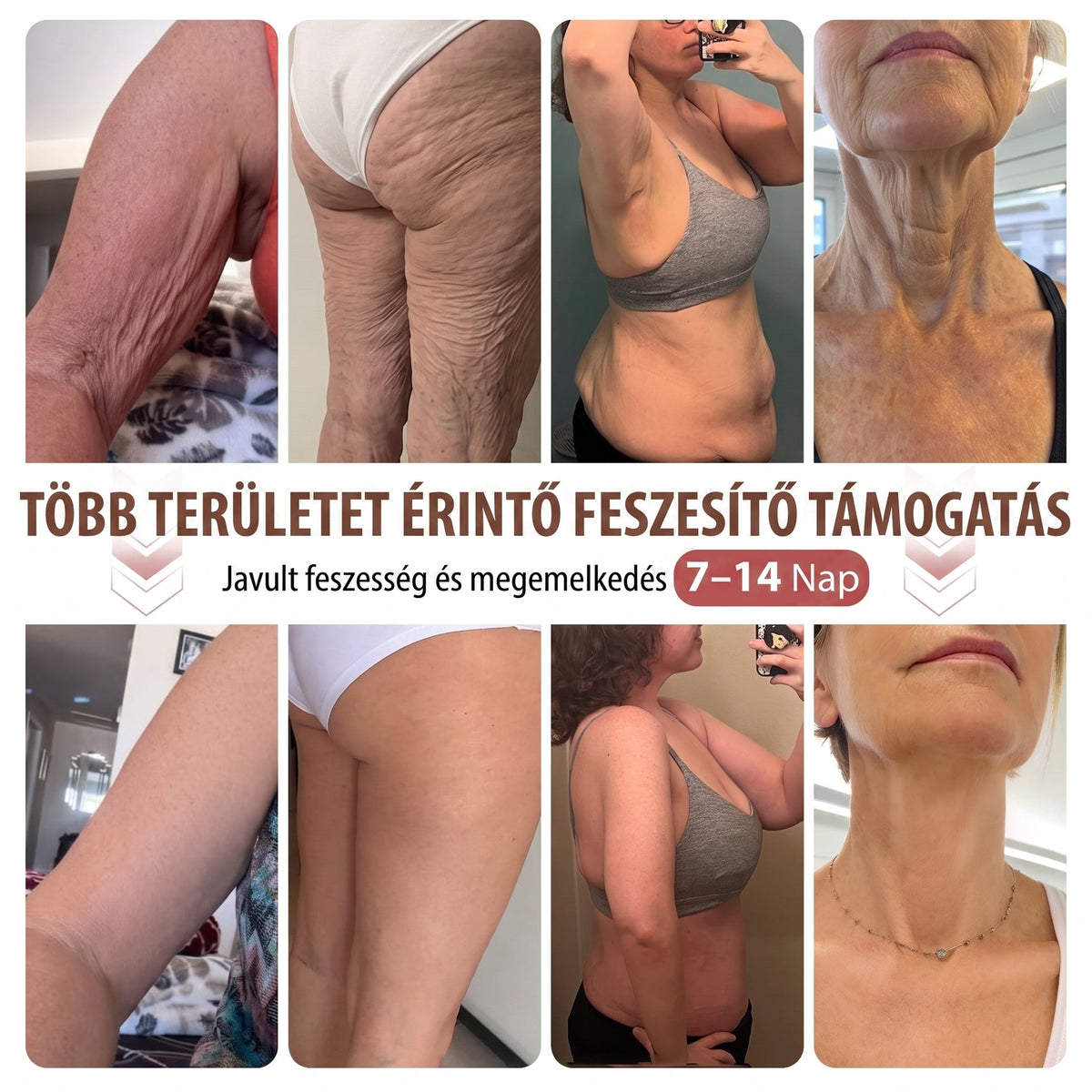 🔥 HISKIN® Nano Mikrotűs Mellvolumen-növelő és Feszesítő Kezelés ✨ Fejlett Nőies Kontúrápoló Rendszer | Kollagénpeptid és Hialuronsav Technológia 🌸